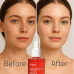 ANUA NIACINAMIDE 10% + TXA 4% DARK SPOT CORRECTING SERUM