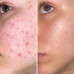 Dr. Clinic Face Serum Salicylic Acid 2% – Blemish & Pore Control